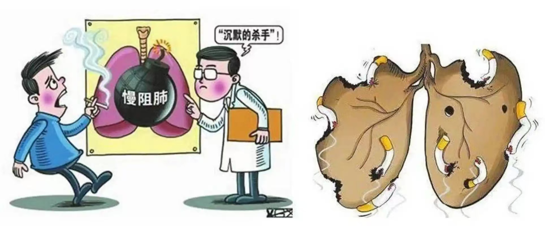 沉默的殺手——慢阻肺 沉默的殺手——慢阻肺